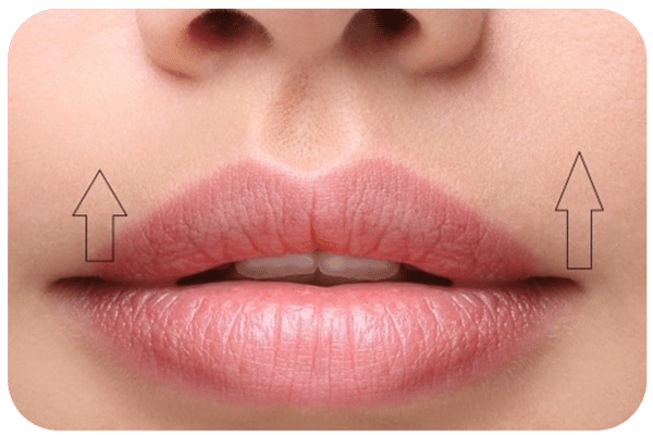 توصیه های مهم برای استفاده از لیفت سانترال لب