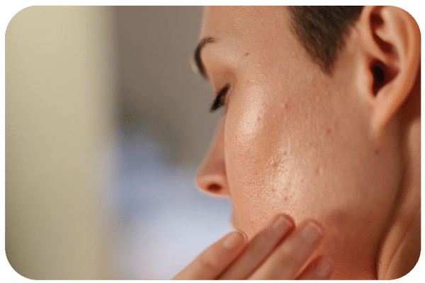 محتویات کوکتل های درمان جوش و آکنه