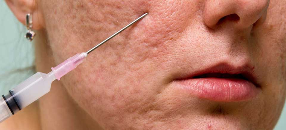 توصیه های مهم برای استفاده از سابسیژن