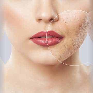 منافذ باز پوست چیست؟