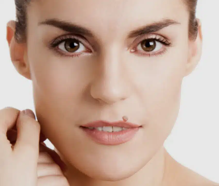 روش های مختلف خال برداری