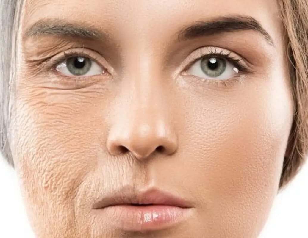 توصیه های مهم برای استفاده از جوانسازی دور چشم